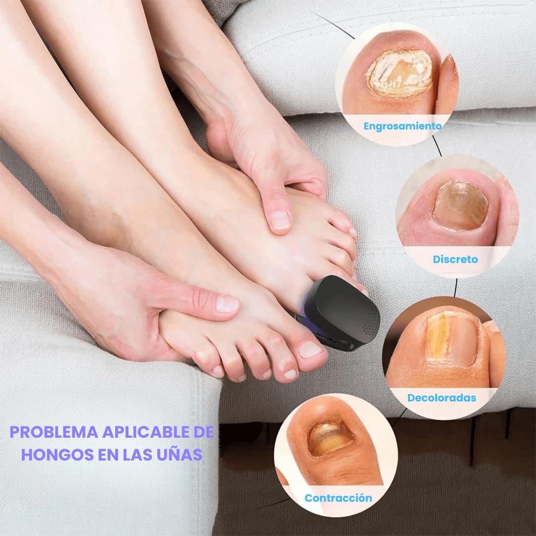 Tratamiento CureNail Led con luz azul y roja activada