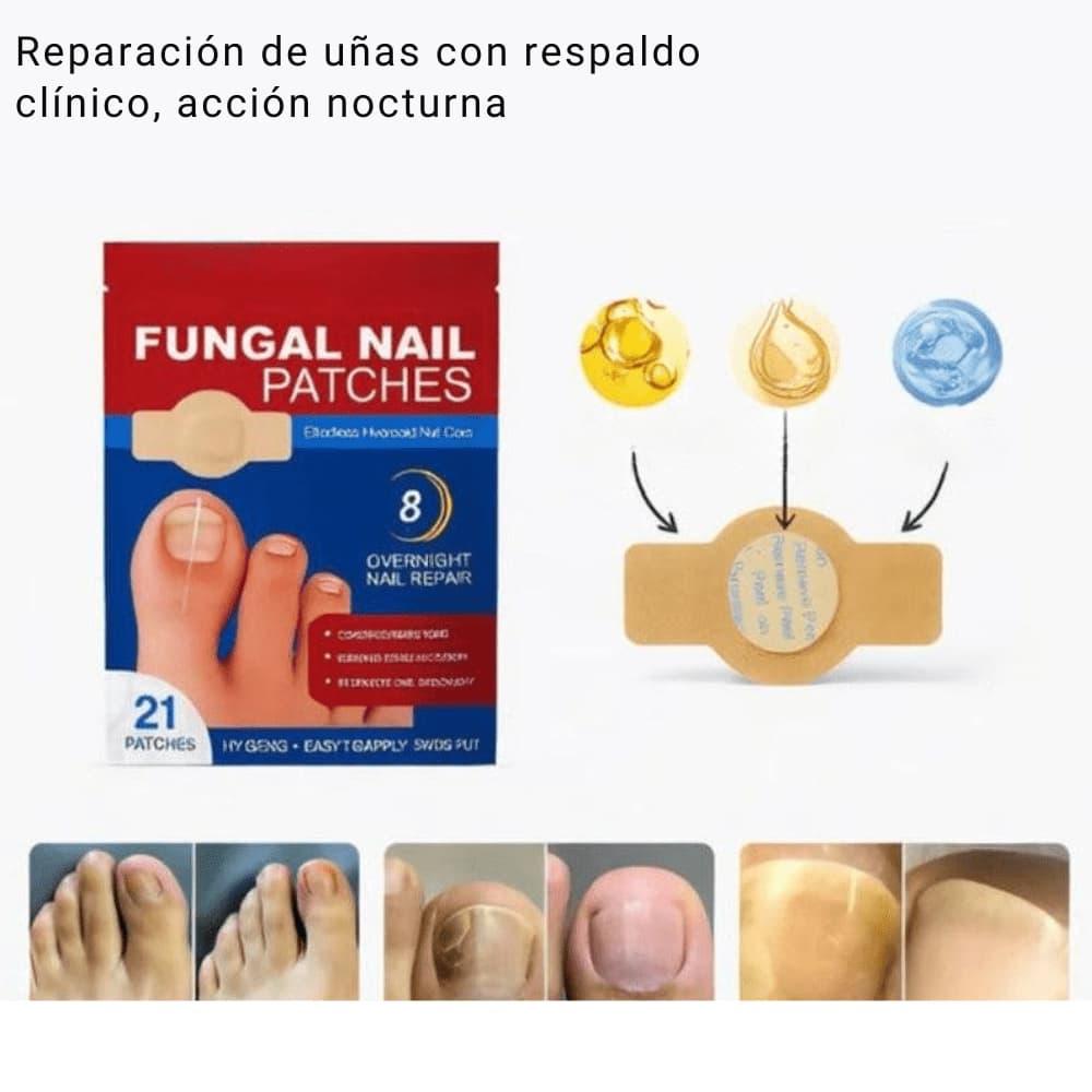 Envase completo Fungal Nail Patches incluido