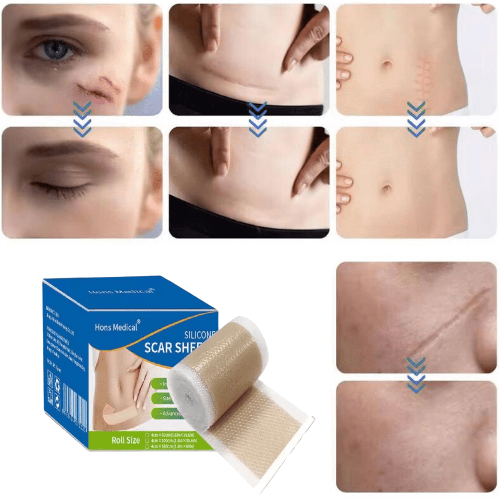 TapeRepair - Bulkizz