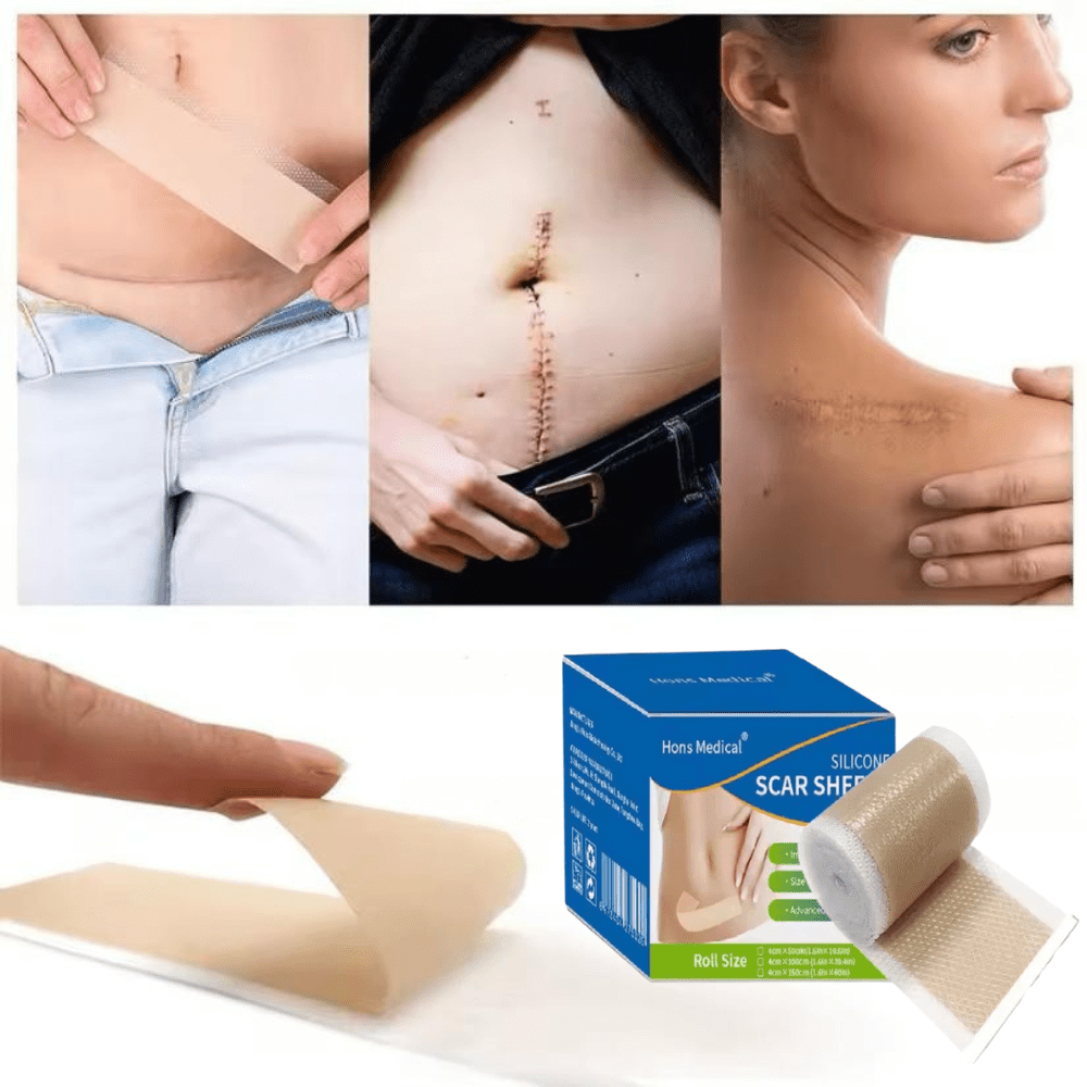 TapeRepair - Bulkizz